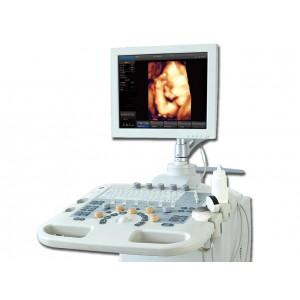 ECHOCOLOUR DOPPLER CHISON IVIS 30