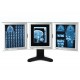 NÉGATOSCOPE DE BUREAU ULTRA-FIN LED 42x36 cm - triple