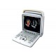 ECOCOLOURDOPPLER PORTABLE CHISON Q5
